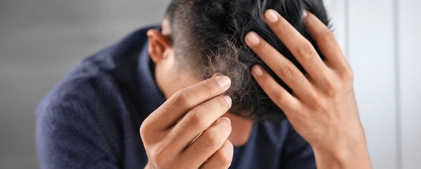 Does Creatine Cause Hair Loss?