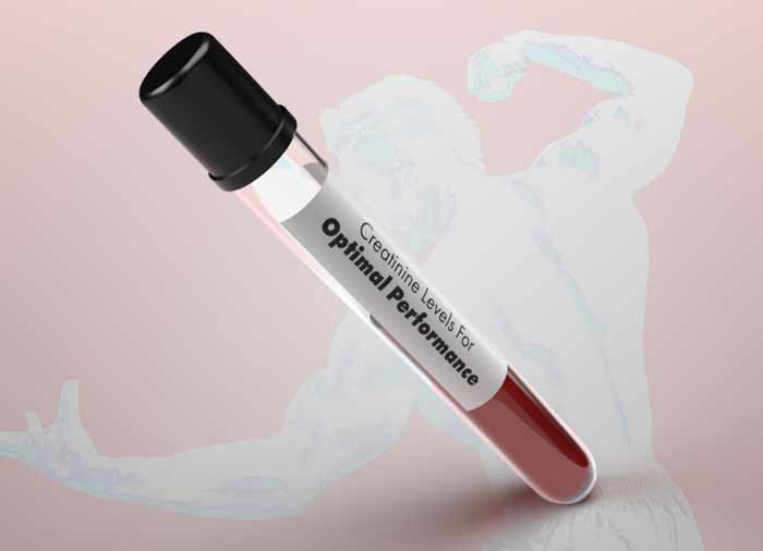 Everything You Should Know About Creatinine Levels For Health & Fitness