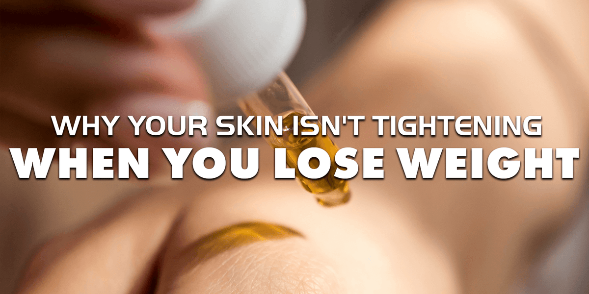 Why Your Skin Isn't Tightening When You Lose Weight